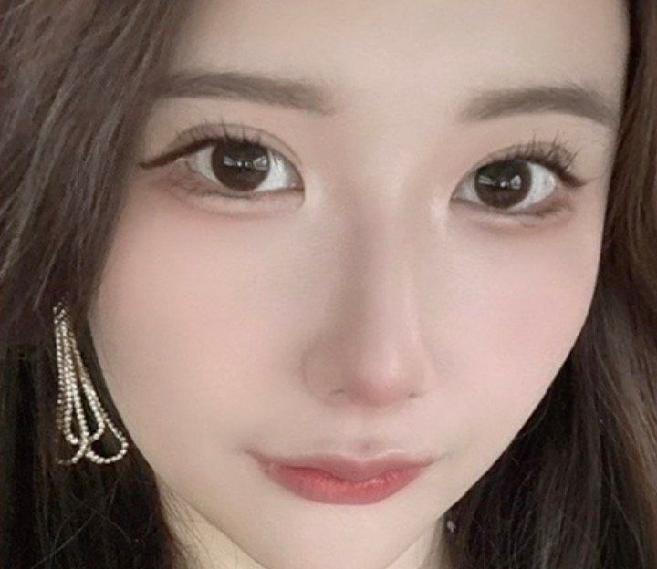 【写真・画像】整形総額1300万円の美女、“整形で縦長にした”パーツに驚きの声「なんで！？」 1枚目