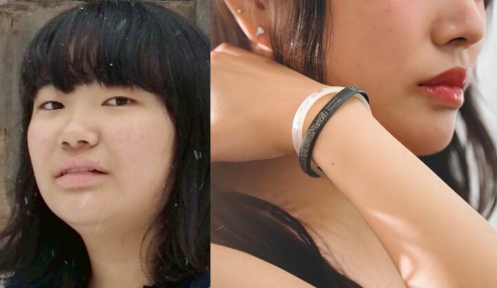 【写真・画像】美人上智大生（21歳）、整形前の顔を公開し驚きの声「変わるね〜」かかった費用も告白 1枚目