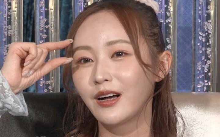 【写真・画像】「整形総額1000万円」てんちむ（32）、整形遍歴＆ダウンタイムを公開「トレンドに合わせて…」 1枚目