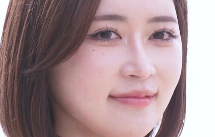 【写真・画像】「全然違う！」整形総額1000万円の26歳美女のビフォーアフターに衝撃「綺麗な人やな」 1枚目