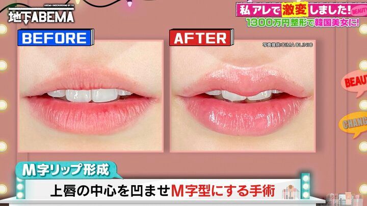 【写真・画像】稲垣吾郎の整形シミュレーションにツッコミの声「バランスが大事！」 2枚目