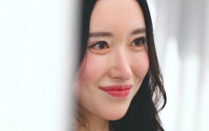 【写真・画像】「肌治療入れると1000万円はいく」パチンコ店勤務の整形美女（24歳）、整形依存を告白「いつかはやめなきゃいけない。止めてくれる人が現れてほしい」 1枚目