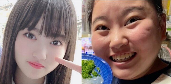 【写真・画像】“アイドル卒業後3ヶ月で30キロ増”75キロ→40キロに激痩せした元アイドルの食事内容に驚きの声「リスだってもうちょっと食べてる」 1枚目