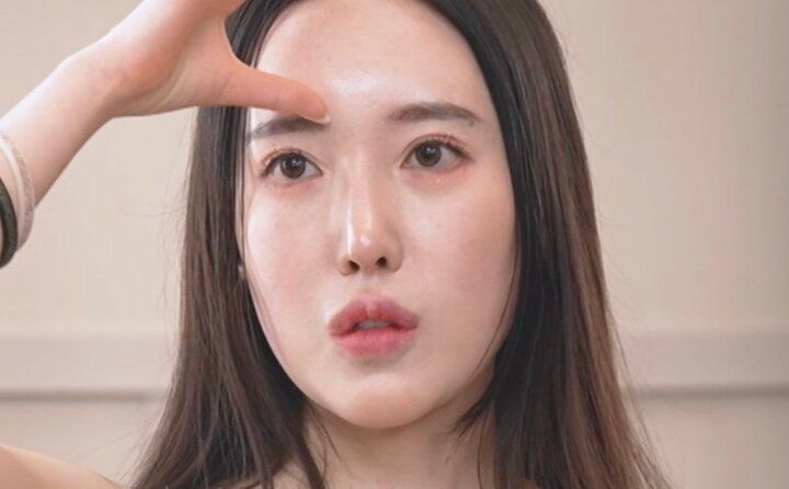 【写真・画像】24歳整形美女、“3度の目の手術”とそのダウンタイムを語る「目をつむるたびに痛かった」 1枚目