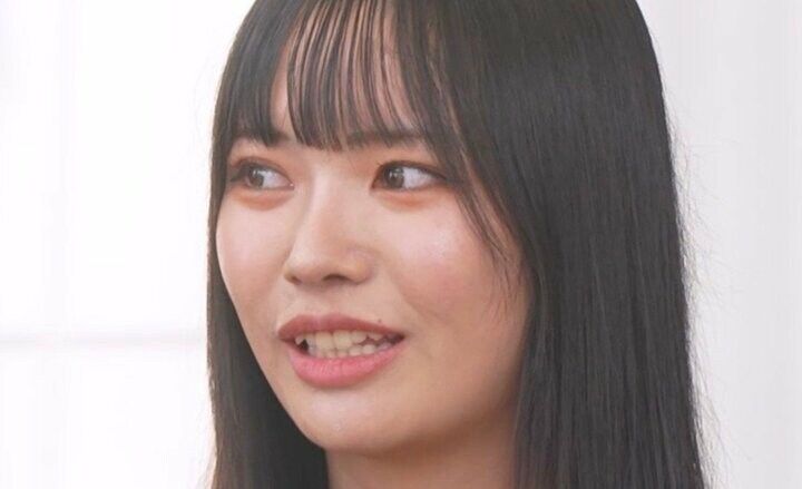 【写真・画像】「鼻の中の骨をパズルみたいにくり抜いて…」21歳美人女子大生、自身の鼻整形の詳細を語る「鼻は必修科目なんで」 1枚目