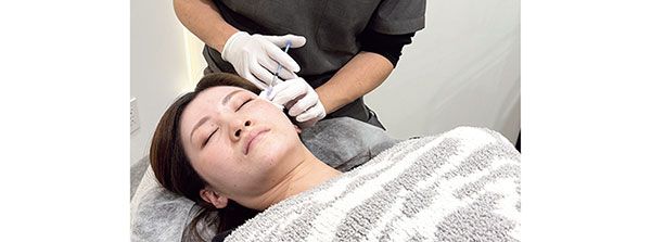 アンジークリニック ACRS療法