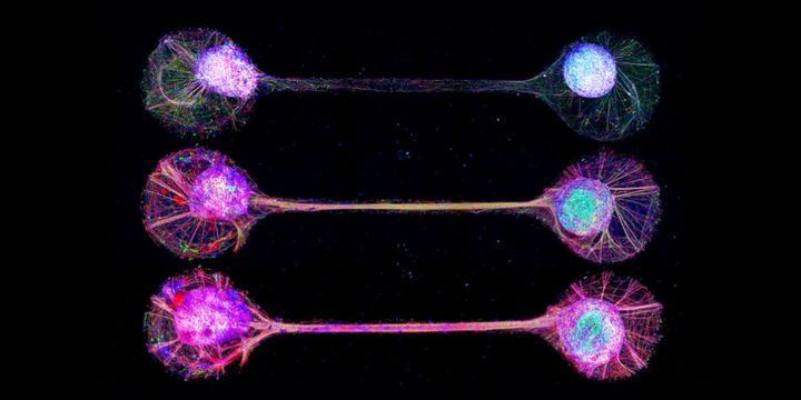 ヒト細胞で作った「ミニ脳」を神経で接続――東京大学が見た「会話する脳オルガノイド」の世界