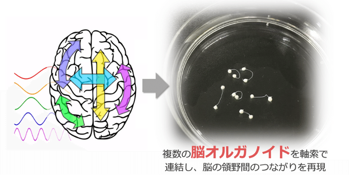 長距離接続がつくる「賢いネットワーク」と、人間性への手がかり