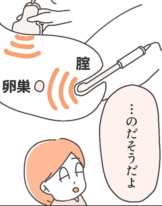 子宮全摘後のリアル／宮島もっちー