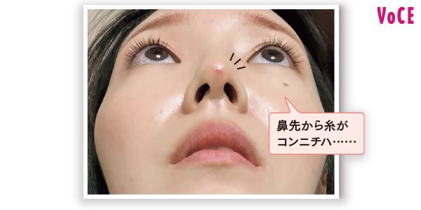 鼻先から糸がコンニチハ……