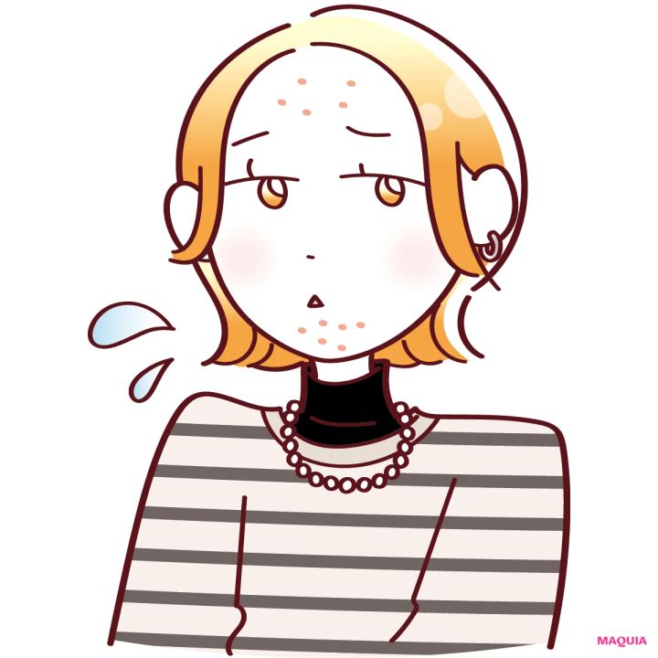 皮脂多めで毛穴が詰まりやすい「ニキビゆらぎ肌」