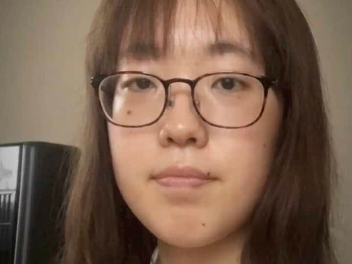 【写真・画像】いじめが原因で整形決意…24歳整形依存美女、整形前の写真を公開「お母さんじゃなくて？」驚きの声 1枚目