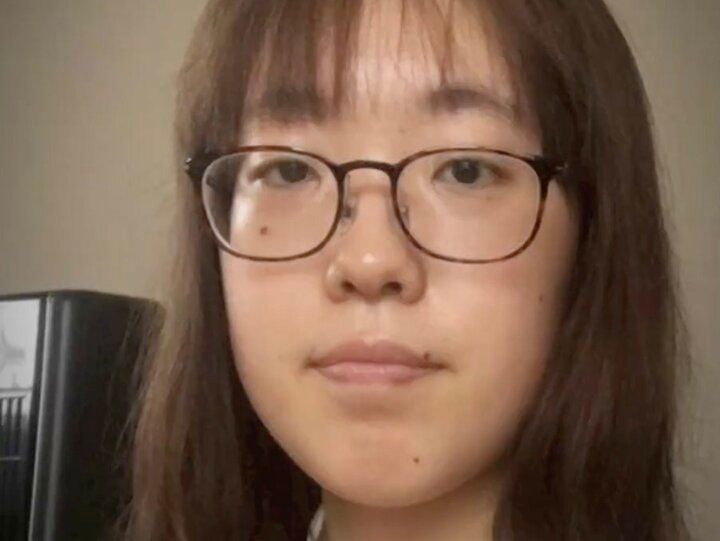 【写真・画像】いじめが原因で整形決意…24歳整形依存美女、整形前の写真を公開「お母さんじゃなくて？」驚きの声 1枚目