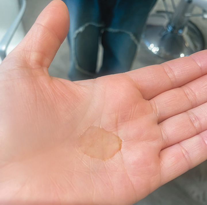 ④Obagi「オバジC10セラム」