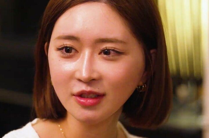 【写真・画像】「一回顔剥がしてるから感覚ない」1000万整形美女（23歳）、整形後の違和感明かす 1枚目