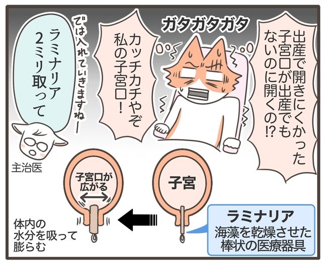 貧血放置で子宮筋腫手術／宮島もっちー