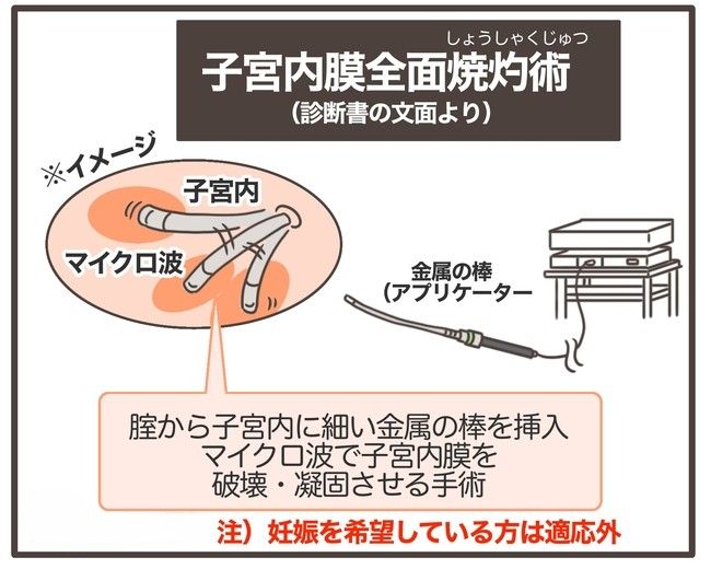 貧血放置で子宮筋腫手術／宮島もっちー