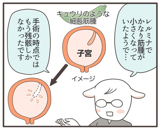 貧血放置で子宮筋腫手術／宮島もっちー