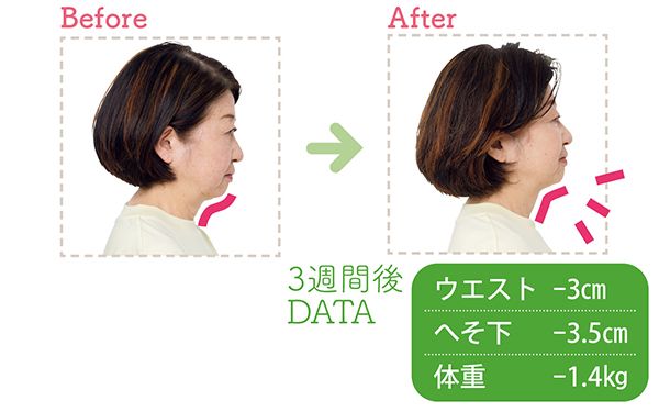 あごの下がスッキリ！首が長く見えるようになりました