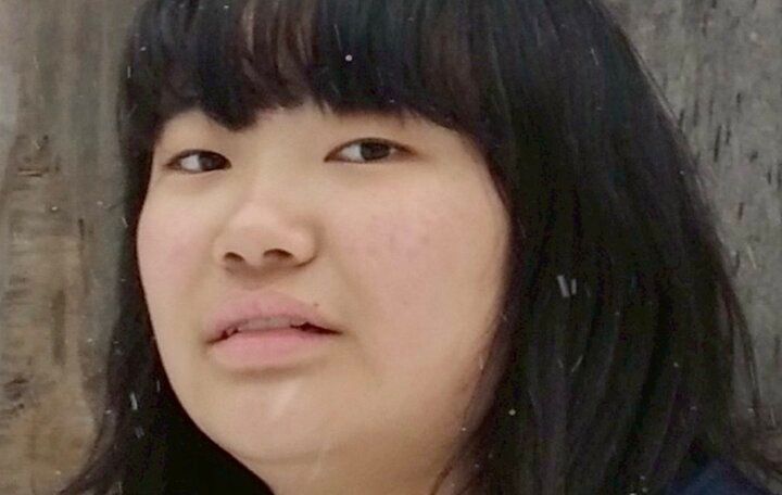 【写真・画像】21歳美人上智大生、整形前の元カレからの残酷すぎる仕打ち「私の顔や体型をバカにする友達や兄弟に便乗した」 1枚目