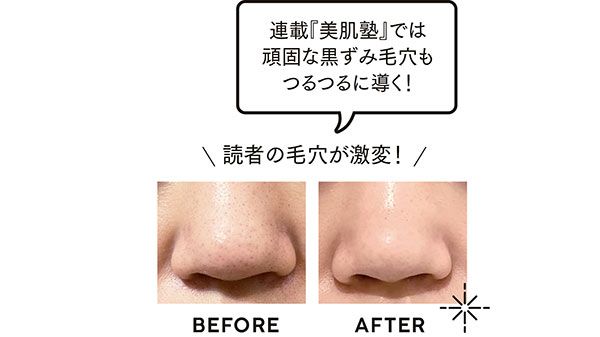 連載『美肌塾』では、頑固な黒ずみ毛穴もつるつるに導く！ BEFORE→AFTER「読者の毛穴が激変！」
