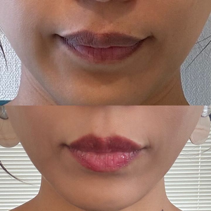 使用ビフォーアフター