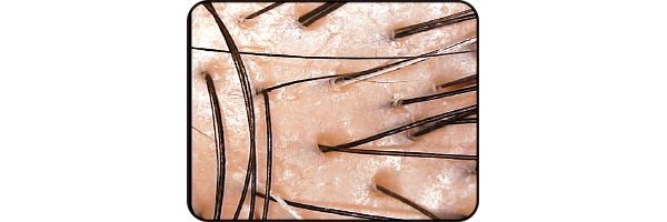 潤っている頭皮