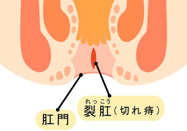 肛門