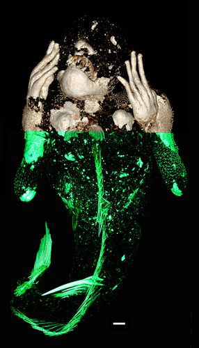 上半身と下半身のX線スキャン画像