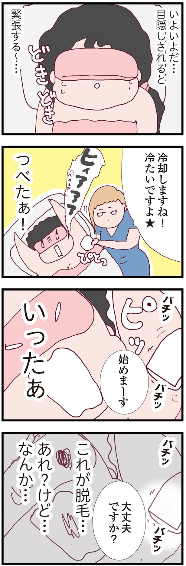 これが脱毛… （C）マルコ／KADOKAWA