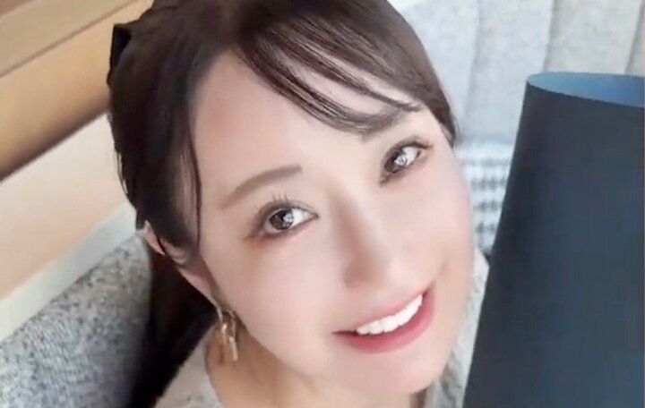 【写真・画像】整形総額2000万円“奇跡の49歳”が整形にハマった理由を告白「昔から芸能人になるほどではないが可愛い方だった」 1枚目