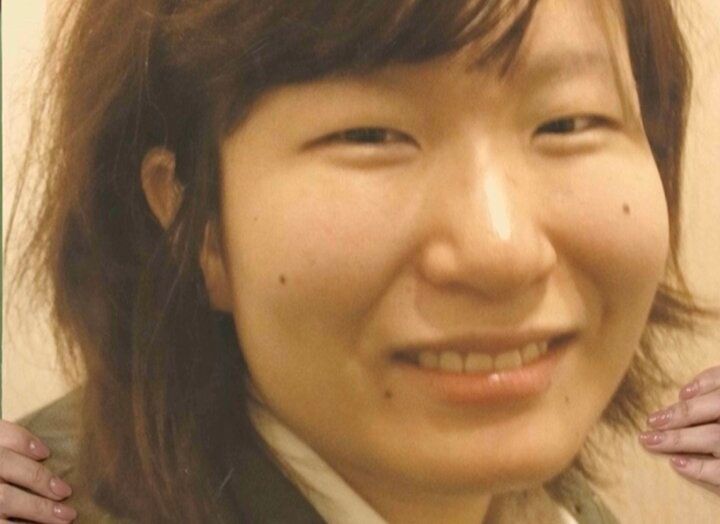 【写真・画像】「整形総額400万円」ワーママ美女の整形ビフォーアフターに絶賛の声「可愛い～！」「元の良さも活かされてる」 1枚目