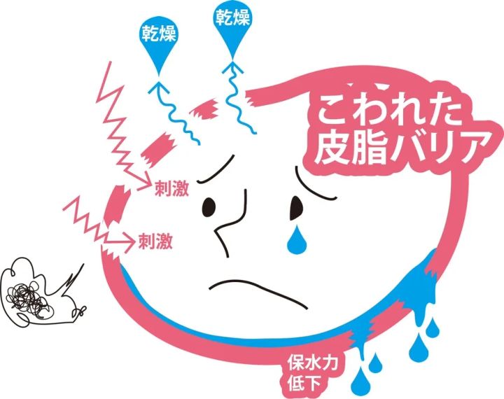 皮脂バリアが崩れた状態を示す模式図