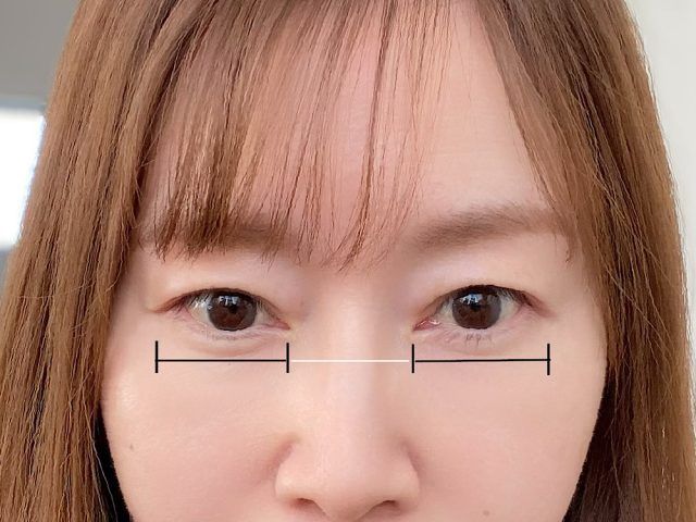 「求心顔」と「遠心顔」のチェック