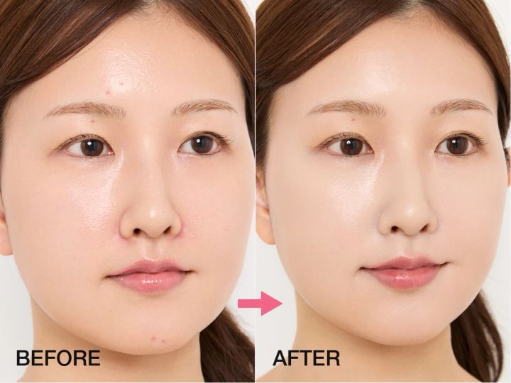 マキアインフルエンサー なーこさん 赤み＆ニキビ悩み BEFORE➡AFTER ヘア＆メイク 小澤桜 プチプラコスメ お悩み カバーメイク ベースメイク 赤み ニキビ 2026春新作