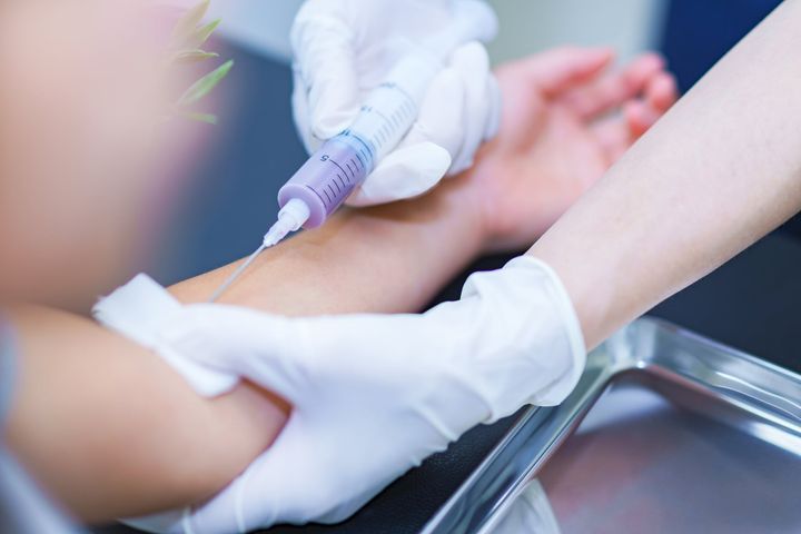 献血時の注意点とは？（画像はイメージ）