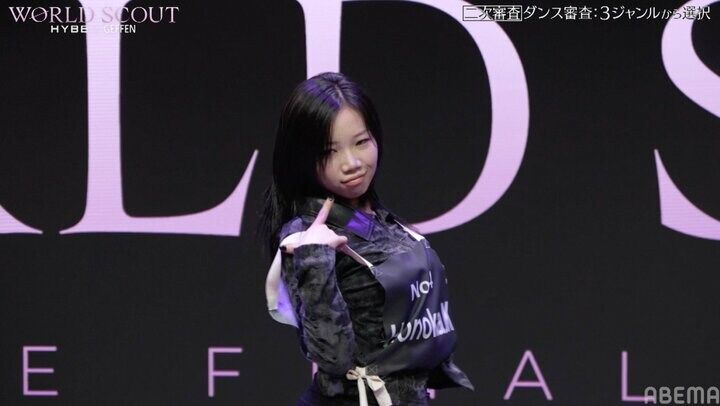 痛々しいほど巨大なアザに指原が衝撃「あそこまでのアザはない」