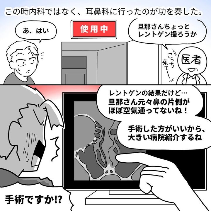 漫画「鼻中隔湾曲症で手術をした話」のカット（yamamiiさん提供）