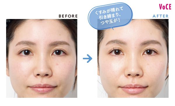 BEFORE AFTER くすみが晴れて引き締まり、つや玉が！