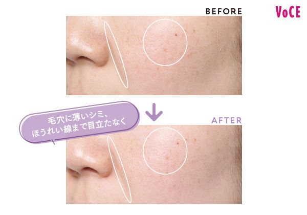 BEFORE AFTER 毛穴に薄いシミ、ほうれい線まで目立たなく