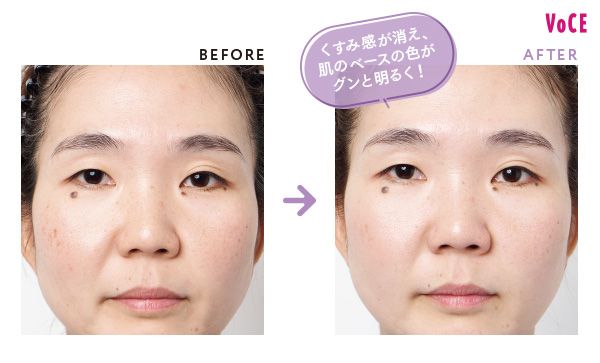 BEFORE AFTER くすみ感が消え、肌のベースの色がグンと明るく！
