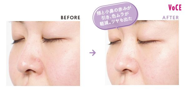 BEFORE AFTER 頰と小鼻の赤みが引き、色ムラが軽減。ツヤも出た
