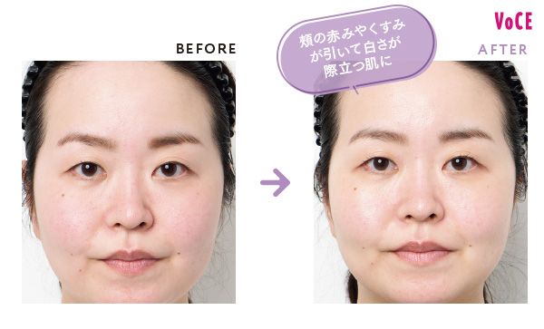 BEFORE AFTER 頰の赤みやくすみが引いて白さが際立つ肌に