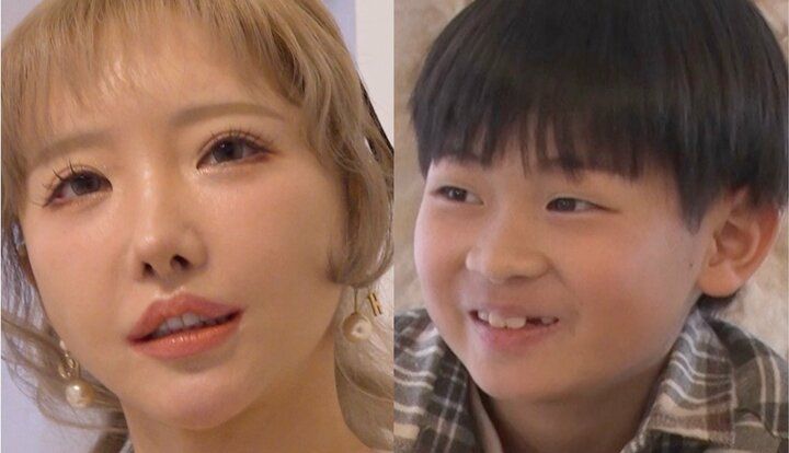 【写真・画像】「整形総額1000万円」12回整形した母について息子たちの本音「もっと可愛くなってほしい」 1枚目