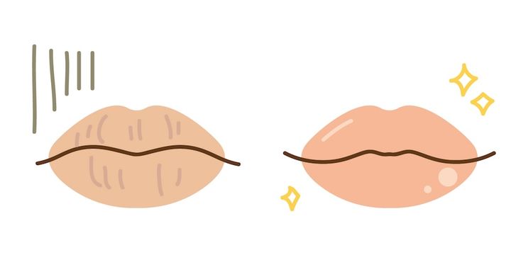 状態が悪い唇といい唇比較イラスト