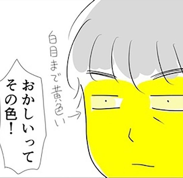 夫のすい臓がんが判明するまで: すい臓がんになった夫との暮らし2 画像提供：倉田真由美(@kuratamagohan) 