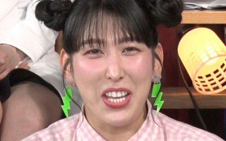 【写真・画像】3時のヒロインゆめっち、整形ダウンタイム中の写真を公開し驚きの声「真っ赤だ！」 1枚目