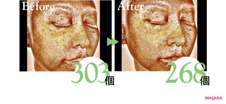 クレ・ド・ポー ボーテ セラムエクラS Ⅱ 使用前後の表面下シミの個数