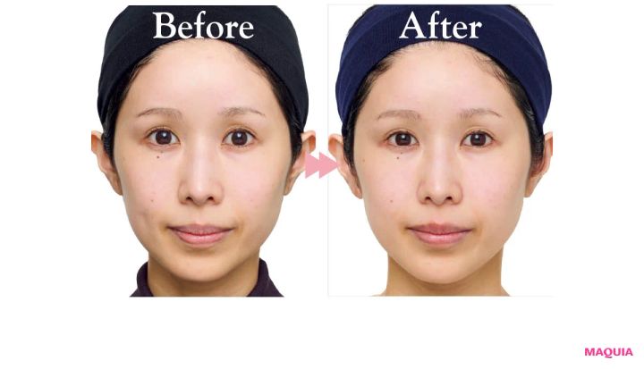 2026年最新作 おすすめブライトニングスキンケアコスメ TAKAMI タカミブライト スポットB3＋ 肌の明るさの変化