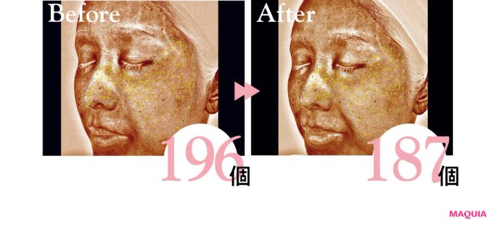 2026年最新作 おすすめブライトニングスキンケアコスメ TAKAMI タカミブライト スポットB3＋ 表面下シミの個数の変化